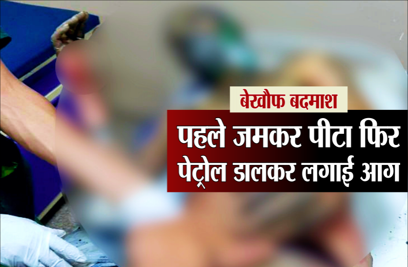 ind_auto.png बेखौफ बदमाश : ऑटो चालक को पहले पीटा फिर पेट्रोल डालकर लगा दी आग, गंभीर हालत में इलाज जारी