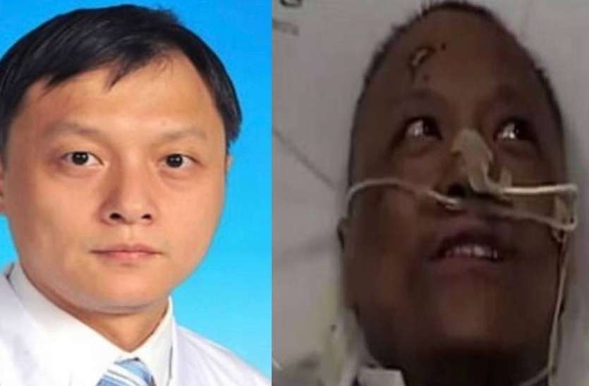 Chinese Doctor Yi Fan कोरोना संक्रमित रहे चीन के डॉक्टर Yi Fan की त्वचा रंग लौटा, बोले- इस वजह से काला पड़ा