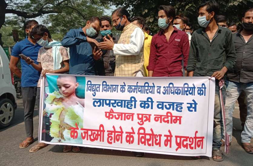 o2902.jpeg बिजली विभाग की लापरवाही के चलते मासूम लड़ रहा जिंदगी और मौत की लड़ाई, लोगों जमकर लगाई फटकार