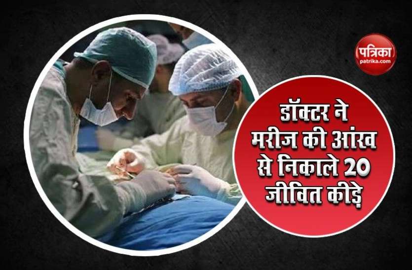 Doctor Removes 20 Live Worms From Man's Eye आंखों में हो रहा था असहनीय दर्द, डॉक्टरों ने मरीज का ऑपरेशन करके निकाले 20 जिंदा कीड़े