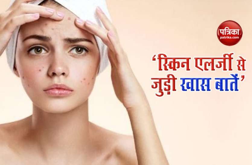हेयर कलर और धूप से भी होती है स्किन एलर्जी की समस्या हेयर कलर और धूप से भी होती है स्किन एलर्जी की समस्या