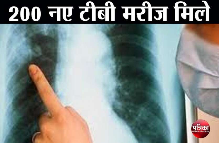 TB patient, 200 new TB patients found, National Tuberculosis, National Tuberculosis 2020 ,National Tuberculosis news 2 से 11 नवम्बर तक चला सघन क्षय रोगी खोज अभियान