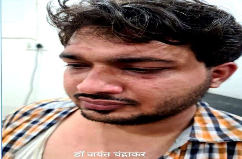 NSUI नेताओं की दबंगई, शहर अध्यक्ष ने दुर्ग जिला अस्पताल के डॉक्टर को लोहे की छड़ से पीटा, कहा सरकार हमारी है, कोई कुछ नहीं बिगाड़ सकता