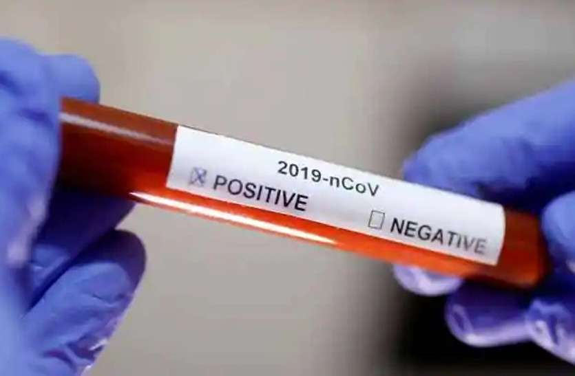 corona in jaipur: Negative in RUHS, Positive in SMS जयपुर: आरयूएचएस में नेगेटिव, एसएमएस में पॉजिटिव, मरीज हो रहे चक्करघिन्नी
