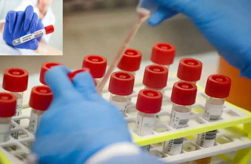antigen.jpg रायपुर समेत 4 जिलों ने जिस एंटीजन किट पर आपत्ति जताई, सीजीएमएससी ने रेंडम जांच में पास कर दिया