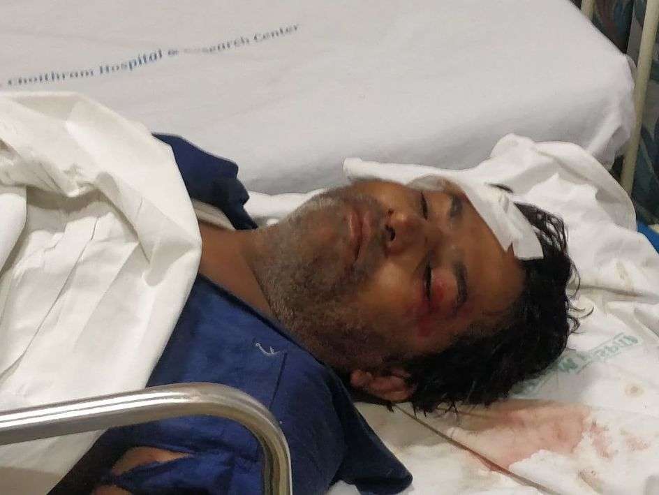 लड़की ने कार से स्टैंड पर खड़े 4 ऑटो को मारी टक्कर, 5 घायल