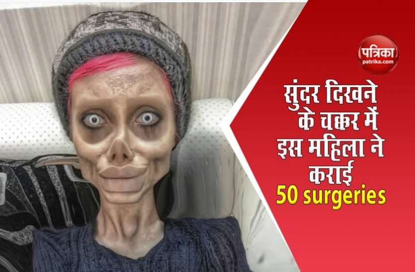 sahar tabar एक्ट्रेस Angelina Jolie जैसी दिखने की चाहत में इस महिला ने कराई 50 surgeries, हुआ ऐसा हाल