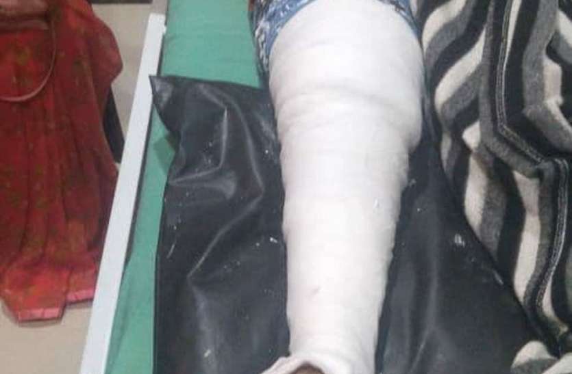Brother and sister serious due to auto collision ऑटो की टक्कर से भाई-बहन गंभीर