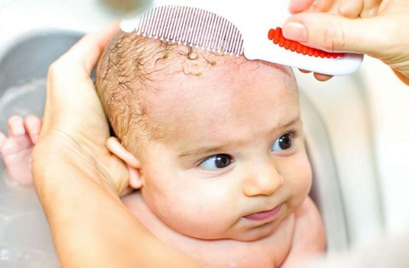 newborns hair beautiful and shiny नवजात बच्चों के बालों को सुंदर और चमकदार बनाने के लिए उपयोग में लाएं Homemade Oil