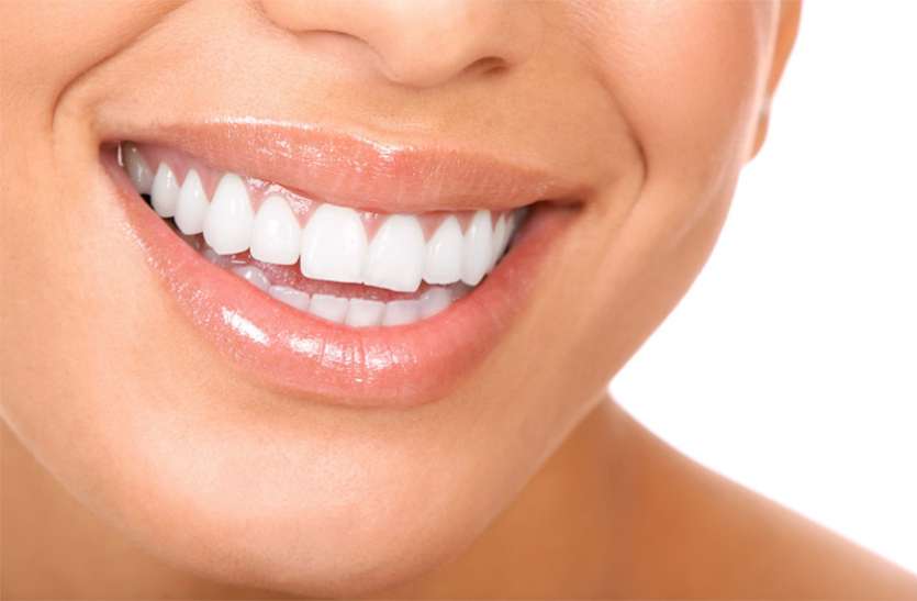 teeth दांतों का रखें ख्याल, इससे जुड़ी हैं कई घातक बीमारियां