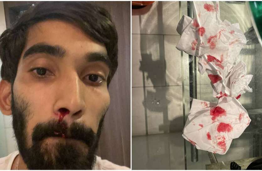 jaipur डॉक्टरों ने खून निकलने के बाद तुरंत श्रीकांत को देखा : बीडब्ल्यूएफ