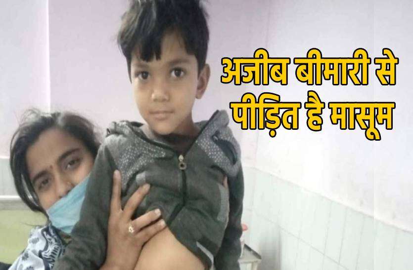 bimari.jpg अजीब बीमारी से पीड़ित है 5 साल का मासूम, डॉक्टर से लेकर सरकार तक हैरान