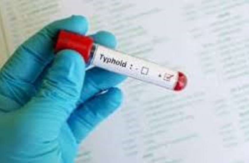 typhoid cases in Chennai increase after rain चेन्नई में बारिश के बाद टाइफाइड के मामले बढ़े