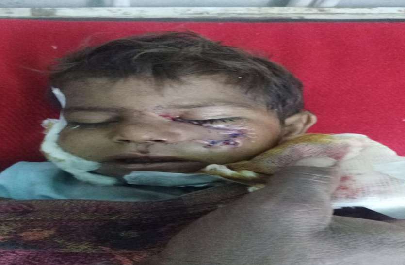 कुत्ते ने पांच जनों को काटा, बच्चे की हालत गंभीर कुत्ते ने पांच जनों को काटा, बच्चे की हालत गंभीर