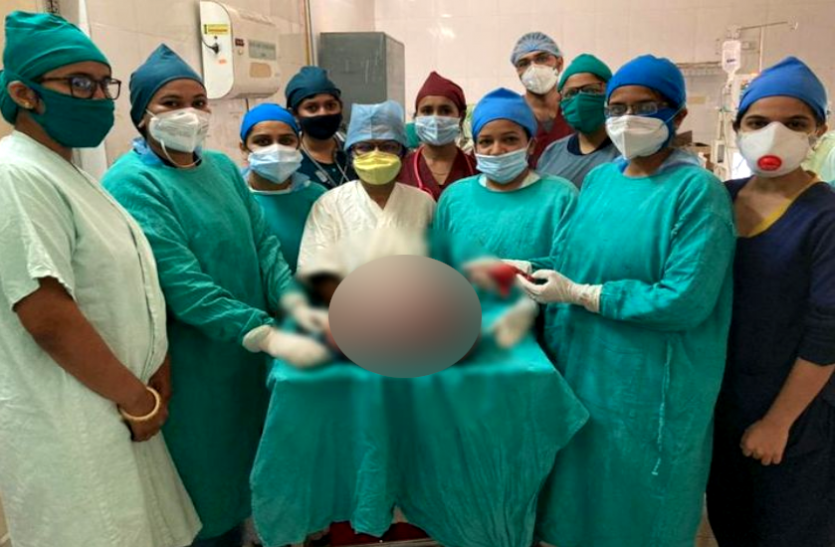news 2 महीनों से लगातार फूल रहा था महिला का पेट, जांच में हुआ चौंकाने वाला खुलासा