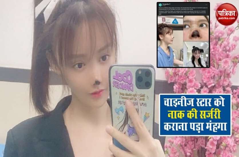 Chinese actress and singer Gao Liu खूबसूरत बनने के चक्कर में चाइनीज स्टार Gao Liu ने कराई नाक की सर्जरी, हुआ ऐसा हाल