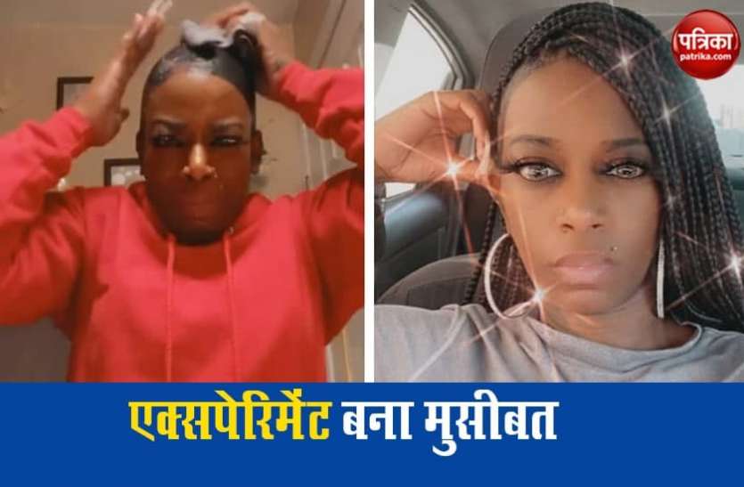 hair1.jpg ग्लू स्प्रे लगाकर बालों को सेट करना महिला को पड़ा महंगा, खाल में चिपक गए हेयर्स