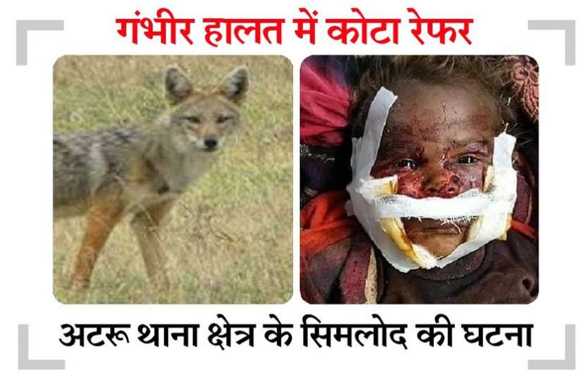 लोमड़ी का हमला, डेढ़ वर्षीय बालक लहूलुहान लोमड़ी का हमला, डेढ़ वर्षीय बालक लहूलुहान