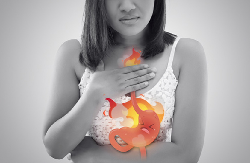 Acidity and irritation Acidity and irritation : एसिडिटी और जलन के कारण हो गए हैं परेशान तो अब अपनाएं ये घरेलू नुस्खे