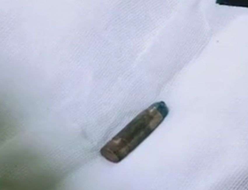 FIRING : कैटरिंग के कारोबार की रंजिश को लेकर पांडेसरा में फायरिंग