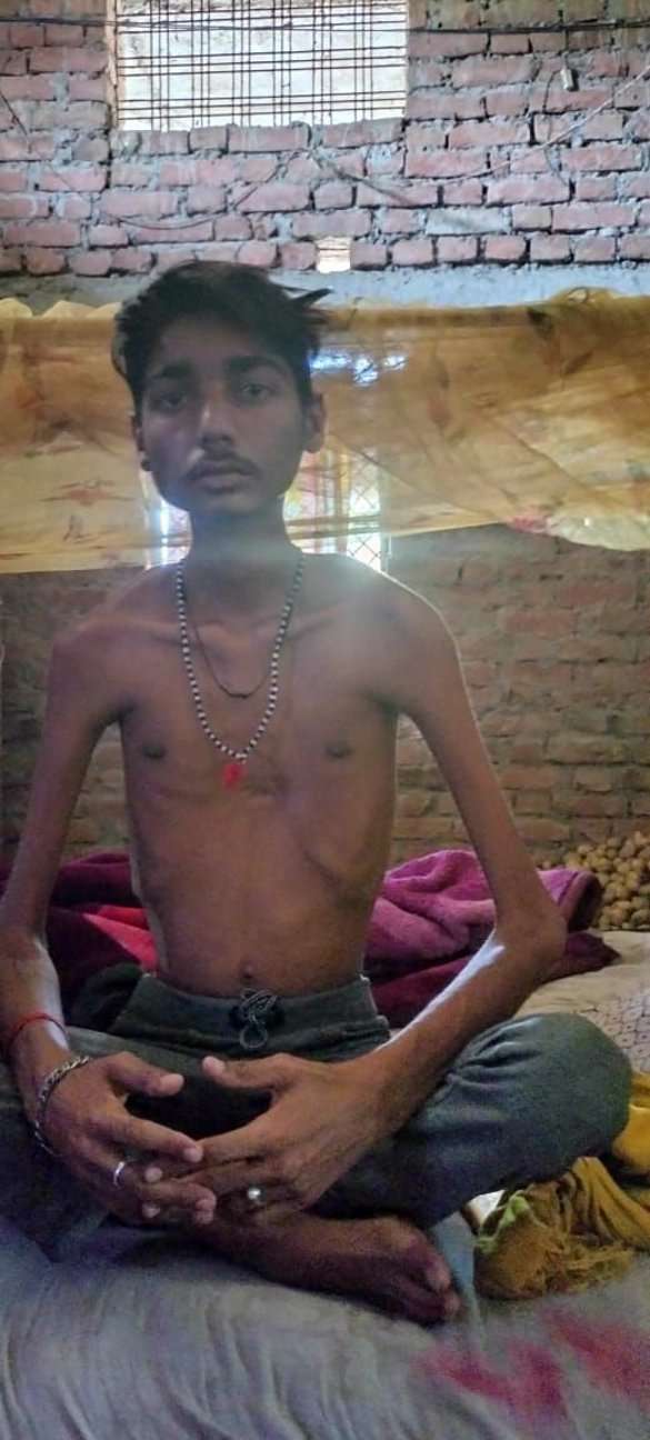 Medical brothers of three brothers, AIIMS and America, who were struggling with the disease, could not find out