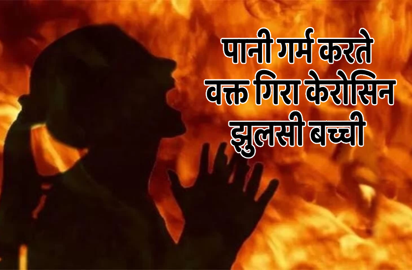 template_1.png पानी गर्म करते वक्त जली बच्ची, समय पर एंबुलेंस न मिलने से भड़के परिजन, हालत गंभीर
