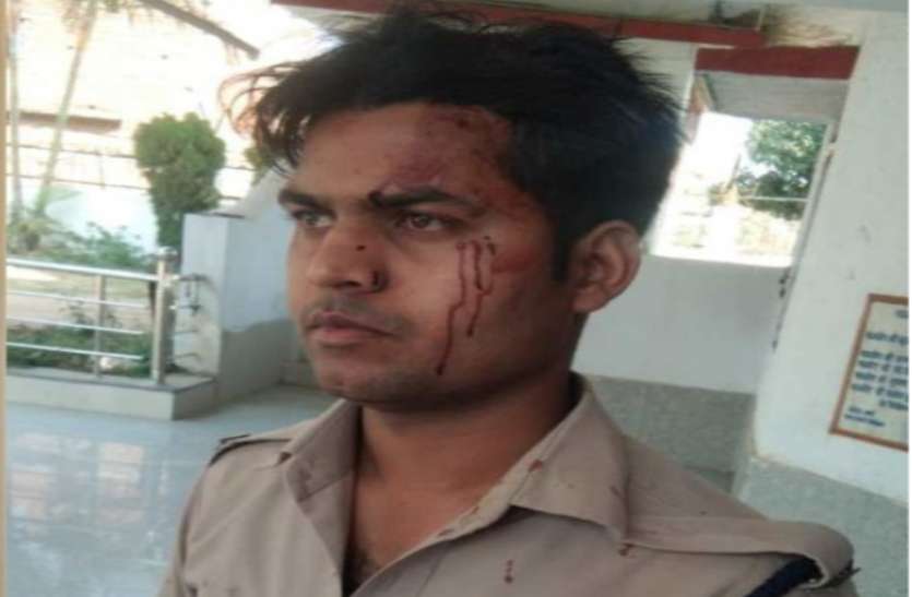 एक और आरक्षक की पिटाई, पहले कुत्ते को घर के सामने शौच कराया, मना किया तो युवकों ने फोड़ा सिर एक और आरक्षक की पिटाई, पहले कुत्ते को घर के सामने शौच कराया, मना किया तो युवकों ने फोड़ा सिर