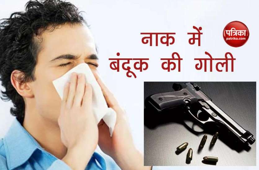 nose 8 साल तक नाक में फंसी रही बंदूक की गोली, डॉक्टर्स ने बड़ी मुश्किल से बचाई जान