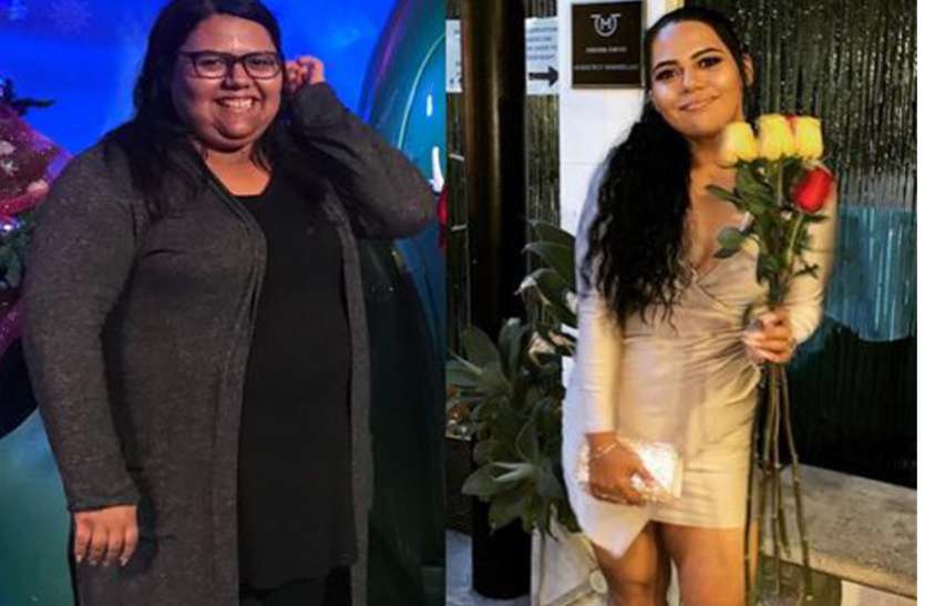 obesity मोटापे के चलते बॉयफ्रेंड ने किया ब्रेकअप, घटाया 65 किलो वजन, अब दिखती है ऐसी
