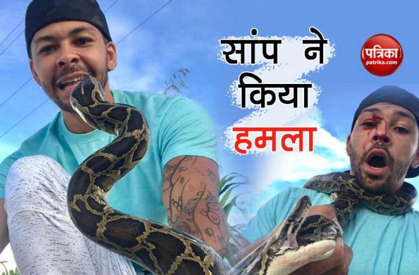 snake सांप के साथ वीडियो बनाना महंगा पड़ा, आंख पर किया हमला