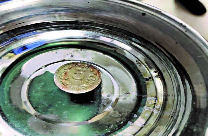 खेल-खेल में दो साल का बच्चा निगल गया 5 रुपए का सिक्का, क्रिटिकल होने से पहले डॉक्टरों ने आहार नली से निकाला