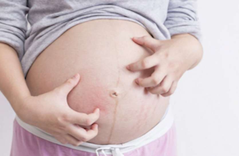 जानें क्या होती है 'False Pregnancy', बिना प्रेग्नेंट हुए भी दिखते हैं प्रेग्नेंसी के लक्षण जानें क्या होती है 'False Pregnancy', बिना प्रेग्नेंट हुए भी दिखते हैं प्रेग्नेंसी के लक्षण