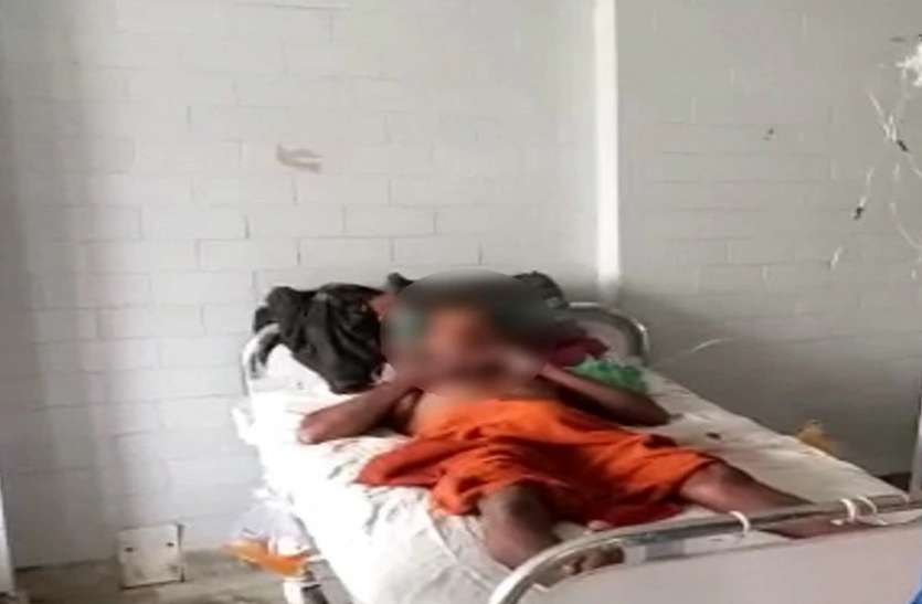 रीवा के अस्पताल में भर्ती जख्मी आरोपी महिला ने पुरुष का काट दिया प्राइवेट पार्ट, जख्मी आरोपी अस्पताल दर अस्पताल बदलता रहा नहीं हुआ आपरेशन