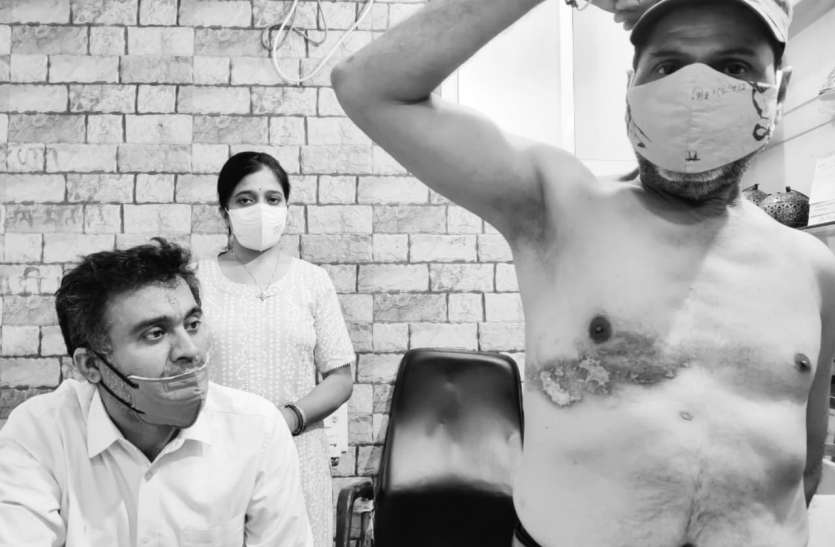 हरपीज जोस्टर - शरीर के आधे हिस्से बीमारी, तेज बुखार जलन और दर्द होता है, जाने इलाज हरपीज जोस्टर - शरीर के आधे हिस्से की बीमारी, तेज बुखार जलन और दर्द होता है, जाने इलाज