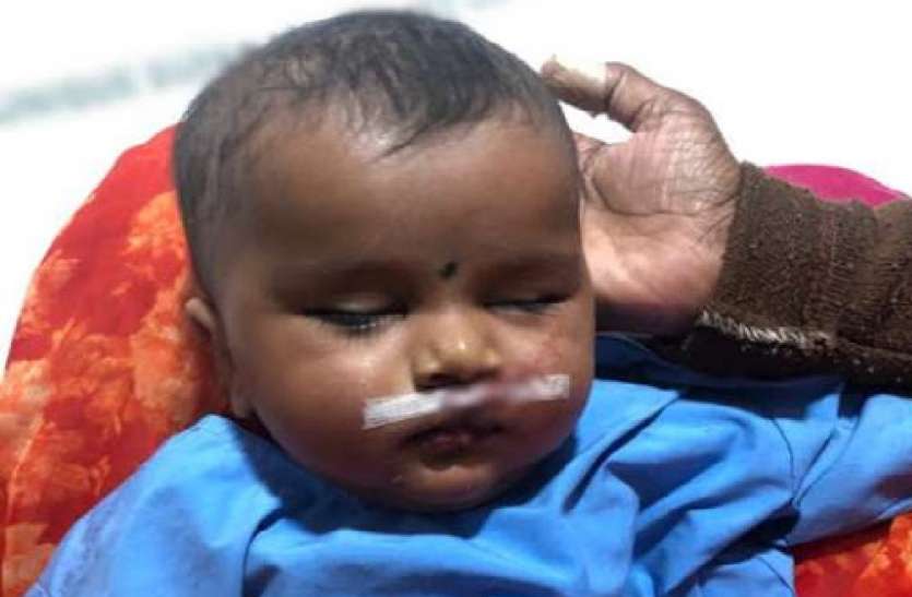 जन्मजात कटे होठ और कटे तालू का निशुल्क पंजीकरण, 38 बच्चों का हुआ रजिस्ट्रेशन जन्मजात कटे होठ और कटे तालू का निशुल्क पंजीकरण, 38 बच्चों का हुआ रजिस्ट्रेशन