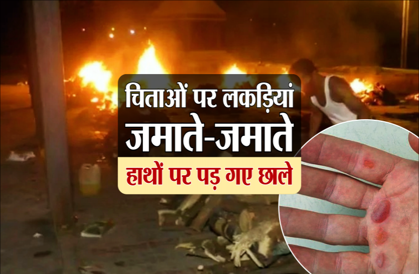 chita.png 53 कोरोना संक्रमित मरीजों की मौत, चिताओं पर लकड़ियां जमाते-जमाते हाथों पर पड़ गए छाले