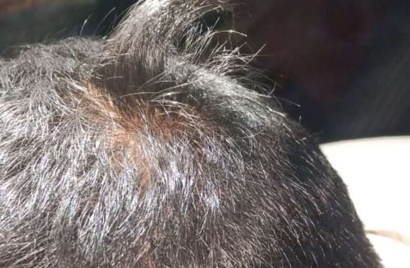 1708.jpg युवक की चोटी काटने को लेकर हंगामा, आमने-सामने आए दो पक्ष
