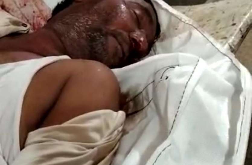 OMG कोरोना संक्रमित मरीज का शव खून से लथपथ, भड़के परिजनों ने गृहमंत्री से की शिकायत OMG कोरोना संक्रमित मरीज का शव खून से लथपथ, भड़के परिजनों ने गृहमंत्री से की शिकायत