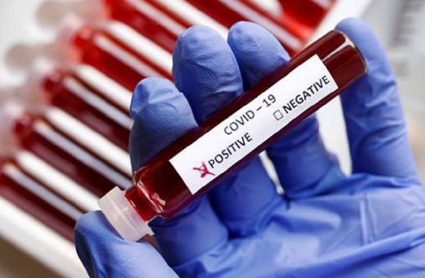 यूपी में कोरोना वायरस से 129 और लखनऊ में 22 लोगों की मौत यूपी में कोरोना वायरस से 129 और लखनऊ में 22 लोगों की मौत