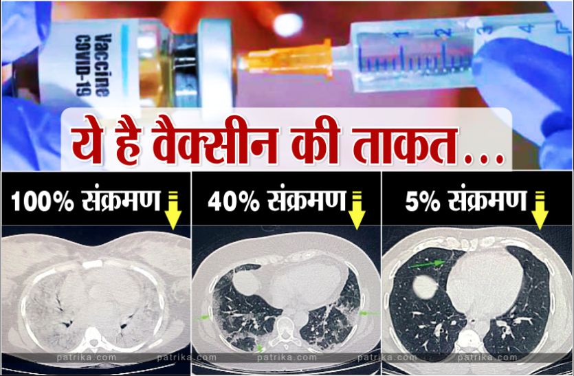 vaccine.png तीन CT Scan इमेज से समझिए क्या है 'कोरोना वैक्सीन' की ताकत