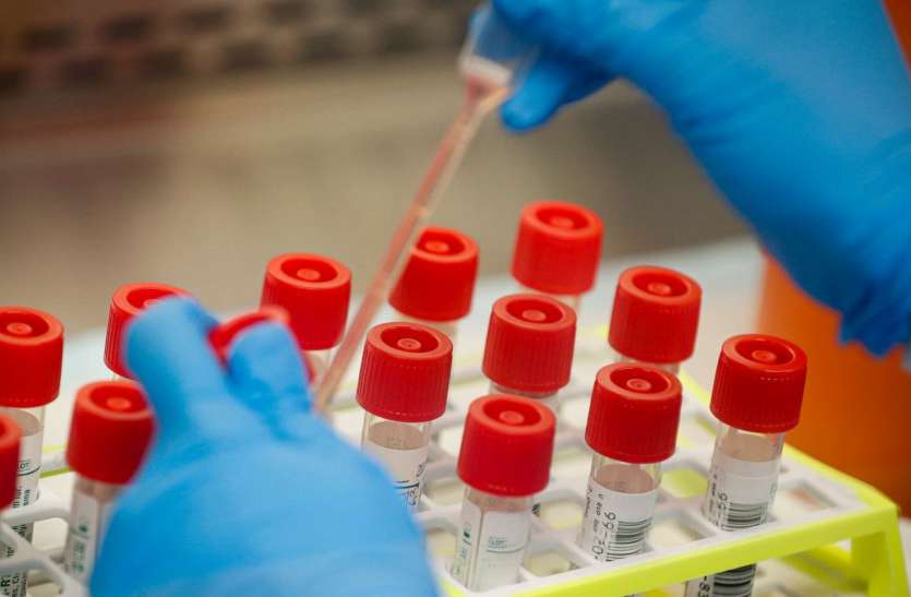 corona test बिहार में कोरोना पॉजिटिविटी रेट में आई तेजी, 24 घंटे में 82 मरीजों की मौत
