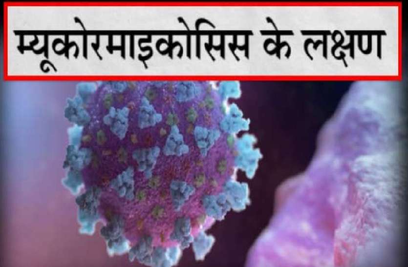 कमजोर इम्युनिटी वालों को हो रहा म्यूकोरमाइकोसिस संक्रमण, जानें इसके लक्षण और बचाव का तरीका कमजोर इम्युनिटी वालों को हो रहा म्यूकोरमाइकोसिस संक्रमण, जानें इसके लक्षण और बचाव का तरीका