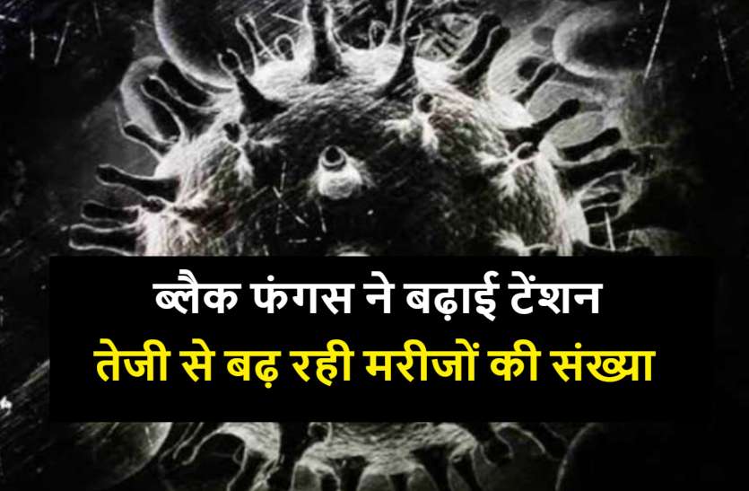 black_fungus_news.jpg कोरोना के बाद नया खतरा: छत्तीसगढ़ में तेजी से बढ़ रही ब्लैक फंगस के मरीजों की संख्या, दुर्ग में मिले 14 नए मरीज