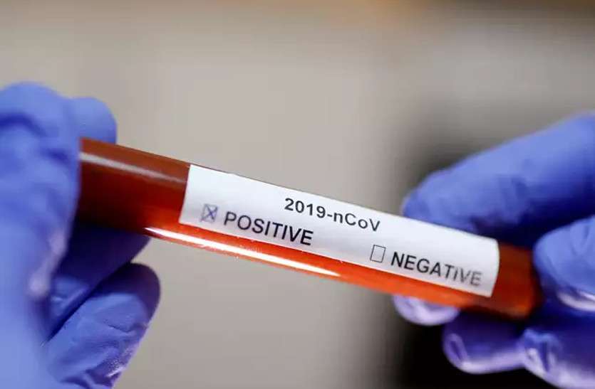 rajasthan coronavirus latest update news प्रदेश को मिली कुछ राहत, 14,289 नए कोरोना संक्रमित मिले, 155 की मौत