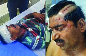 तलवार से जानलेवा हमले में घायल अस्पताल में भर्ती। तलवार से जानलेवा हमले में घायल अस्पताल में भर्ती।
