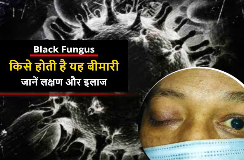 Black Fungus Symptoms In Hindi And What Should Be Done After Infection