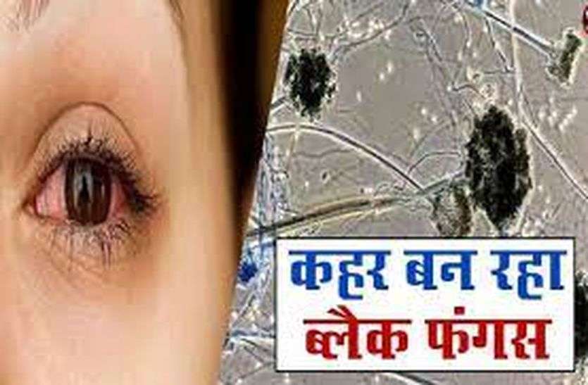 अजमेर में भी होंगे ब्लैक फंगस मरीजों के ऑपरेशन, जेएलएन मेडिकल कॉलेज प्रशासन की कवायद अजमेर में भी होंगे ब्लैक फंगस मरीजों के ऑपरेशन, जेएलएन मेडिकल कॉलेज प्रशासन की कवायद