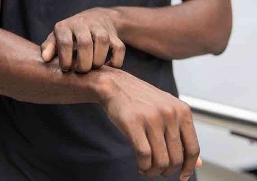सावधान: ब्लैक फंगस से 10 गुना अधिक घातक है वाइट फंगस
