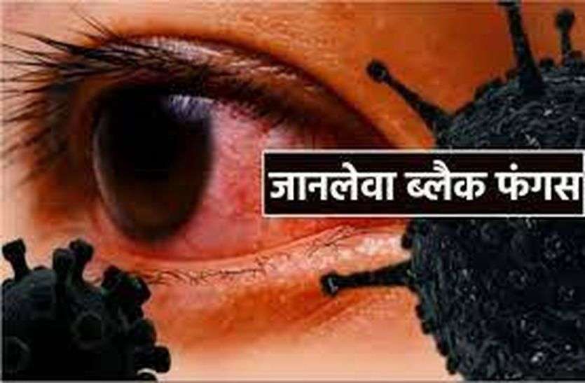 कोरोना से आंशिक राहत, ब्लैक फंगस ने बढ़ाई चिंता, जेएलएन अस्पताल में आठ और मरीजों के ऑपरेशन कोरोना से आंशिक राहत, ब्लैक फंगस ने बढ़ाई चिंता, जेएलएन अस्पताल में आठ और मरीजों के ऑपरेशन
