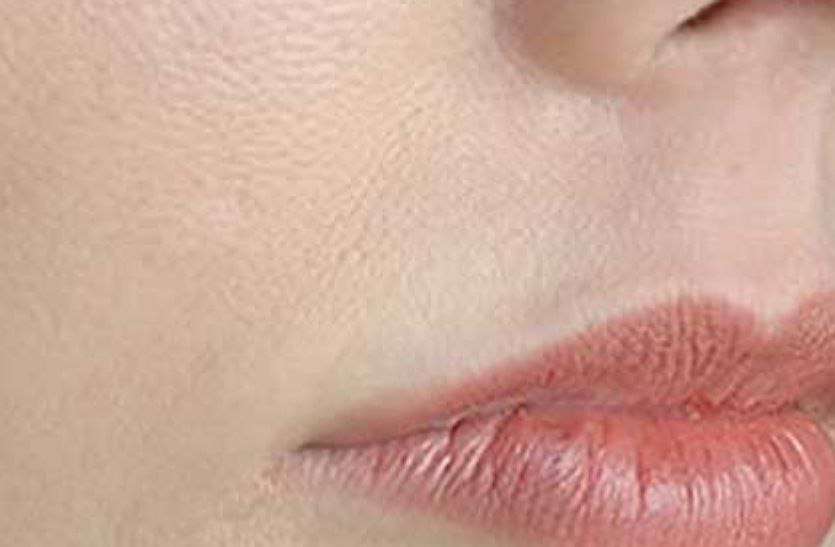 skin pores Home Remedies Skin Pores :- स्किन के खुले पोर्स से होती है यह समस्या, घरेलू उपाय से करें बंद